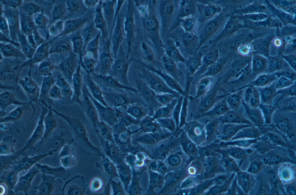 U251 (人胶质瘤细胞系) (STR鉴定正确) U251 (human glioma cells)U-251 MG
