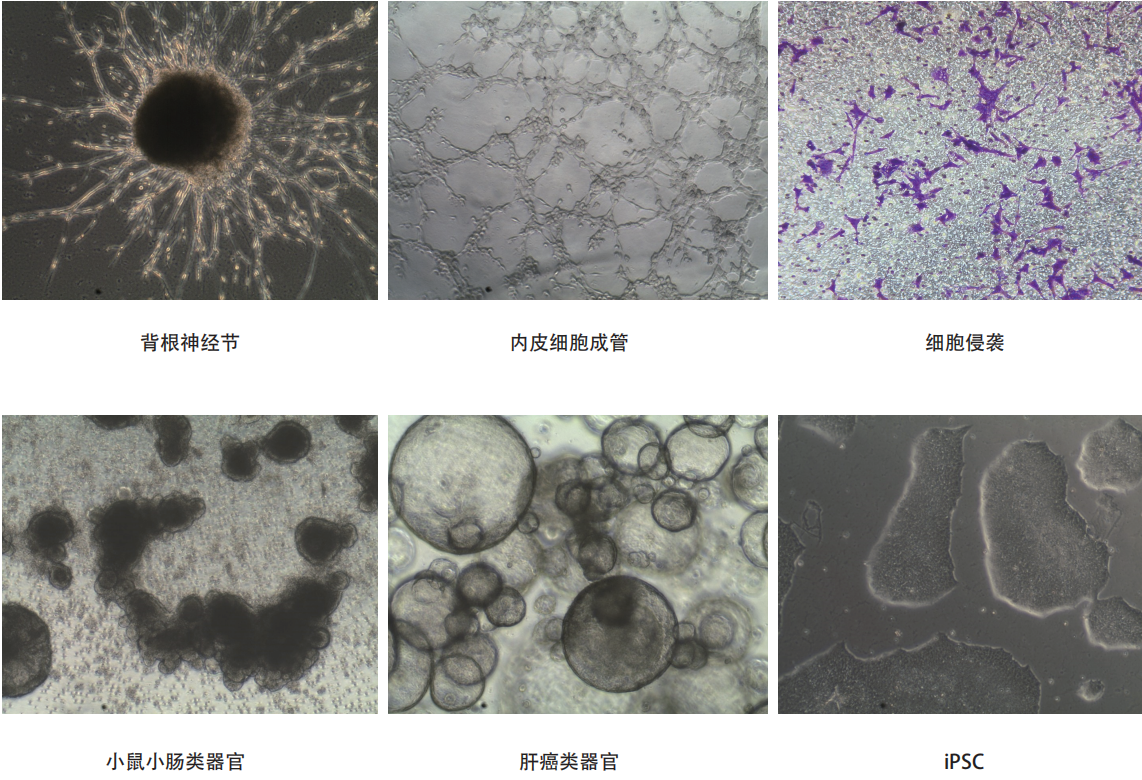 基质胶matrigel(低生长因子GFR，LDEV-free，不含酚红)干冰运输