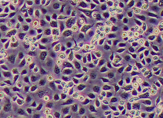 (幼蚊细胞系)C6/36 (Juvenile mosquito cells) C6/36