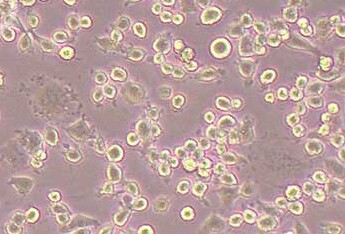 狗肾恶性组织细胞增生症细胞系DH82(种属鉴定) Dog kidney malignant tissue cell proliferation DH82