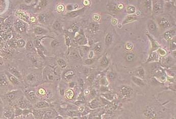 羊子宫内膜上皮细胞永生化(免疫荧光鉴定) Immortalization of sheep endometrial epithelial cells