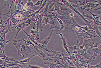 鸡骨骼肌细胞永生化 Immortalization of chicken skeletal muscle cells