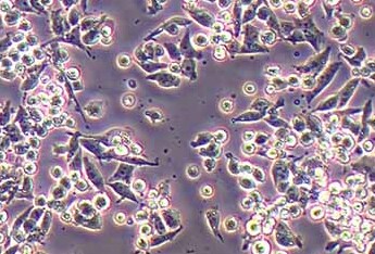 B95-8转化的绒猴白细胞系 B95-8 transformed white blood cells from macaques