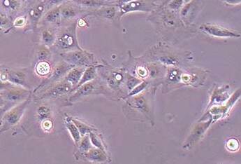 IPEC-J2猪小肠上皮细胞系 IPEC-J2 pig small intestine epithelial cells