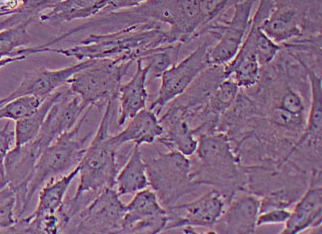 PT-K75猪鼻甲黏膜成纤维细胞系 PT-K75 pig nasal turbinate mucosal fibroblasts