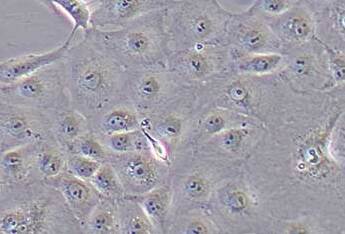 marc145猴胚胎肾上皮细胞系 Marc145 monkey embryonic kidney epithelial cells