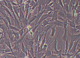 OAR-L1绵羊肺成纤维细胞系 OAR-L1 sheep lung fibroblasts