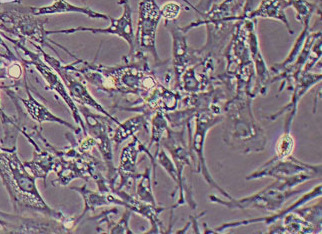 鸡胚成纤维细胞(永生化细胞） Identification of immortalized species of chicken embryo fibroblasts