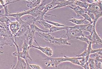 猪主动脉平滑肌细胞(永生化细胞) Immortalization of Porcine Aortic Smooth Muscle Cells - LargeT