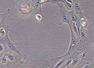猪子宫内膜上皮细胞(永生化细胞) Immortalization of porcine endometrial epithelial cells