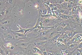 猪扁桃体上皮细胞(永生化细胞) Porcine tonsil epithelial cells (immortalized)
