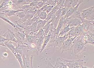 猪骨骼肌卫星细胞(永生化细胞) Porcine skeletal muscle satellite cells (immortalized)