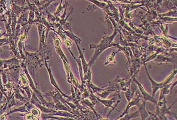 大鼠脑微血管内皮细胞(永生化细胞) Rat brain microvascular endothelial cells (immortalized)