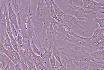 猪脂肪干细胞(永生化细胞) Immortalization of pig adipose derived stem cells