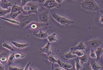 人鼻咽癌细胞系HNE1(STR鉴定正确) Human nasopharyngeal carcinoma cell line HNE1