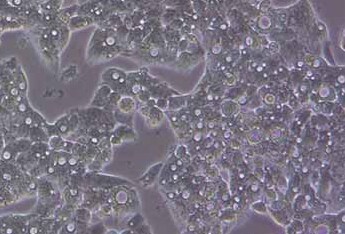 人肝癌细胞系亚型GS-HEPG2(STR鉴定正确) Human liver cancer cell subtype GS-HEPG2