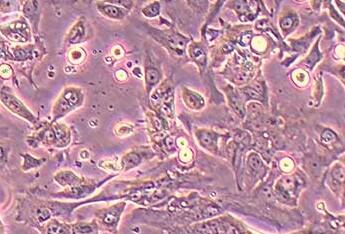 人舌鳞癌细胞系UPCI-SCC-152 UPCI-SCC-152 human tongue squamous cell carcinoma cells