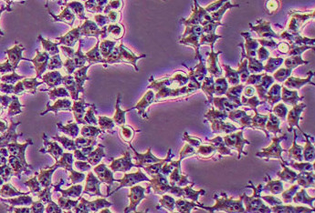人逆转录病毒包装细胞系Plat-E(STR鉴定正确) Human retrovirus packaging cells Plat-E