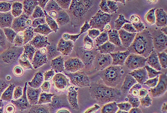人胆管癌细胞系CC-LP-1(STR鉴定正确) Human cholangiocarcinoma cell line CC-LP-1