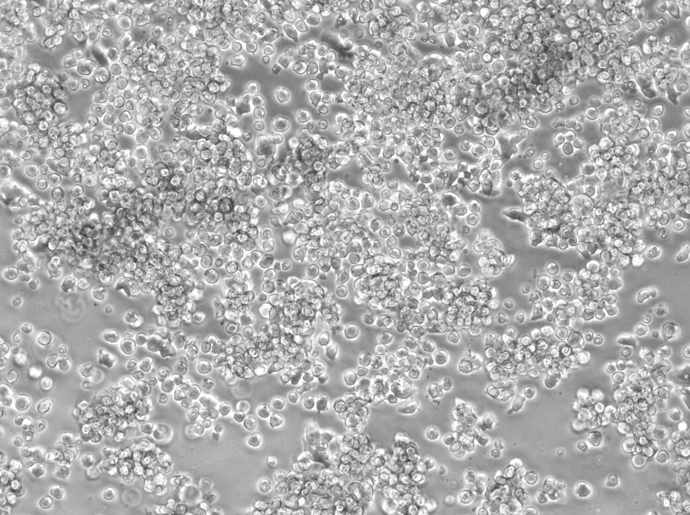 人多发性骨髓瘤细胞系LP-1 Human multiple myeloma cell line LP-1