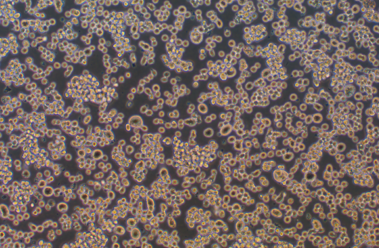 人肥大细胞系HMC-1(STR鉴定正确) Human mast cell HMC-1