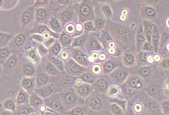 人前列腺增生细胞系BPH-1  (STR鉴定正确) Human benign prostatic hyperplasia cell line BPH-1