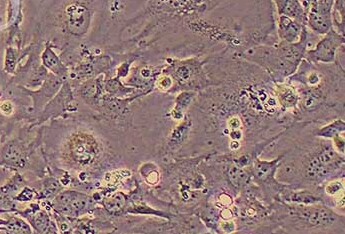人星形胶质细胞系SVG p12(STR鉴定正确) Human astrocytes SVG p12