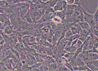 永生化人子宫内膜异位症细胞系12Z(STR鉴定正确) Immortal human endometriosis cell line 12Z