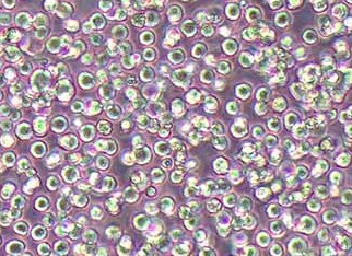 人弥漫大B淋巴瘤细胞系HBL-1(STR鉴定正确)暂不提供 Human diffuse large B-cell lymphoma cells HBL-1