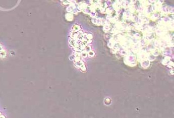 人小细胞肺癌细胞系NCI-H146(STR鉴定正确) NCI-H146 human small cell lung cancer cells