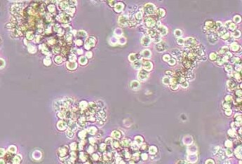 人胃癌细胞系SNU-16(STR鉴定正确) Human gastric cancer cell line SNU-16