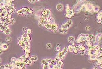 人小细胞肺癌细胞系NCI-H82(STR鉴定正确) Human small cell lung cancer cell line NCI-H82