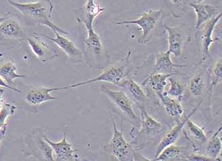 人心脏微血管内皮细胞系-永生化HCMEC Human heart microvascular endothelial cells - immortalized HCMEC