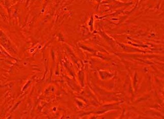人正常结肠上皮细胞系 CCD841 CON (STR鉴定正确)（暂不提供） CCD841 CON in human normal colon epithelial cells