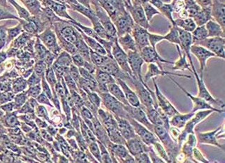 人卵巢癌腺癌细胞系 NIH:OVCAR-8(STR鉴定正确) Human ovarian cancer adenocarcinoma cell line NIH: OVCAR-8