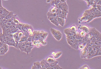 人口腔鳞状细胞系WSU-HN30(STR鉴定正确) Human oral squamous cell WSU-HN30