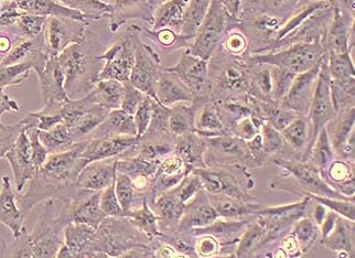 人肝永生化细胞系THLE-2(STR鉴定正确) Human liver immortalized cell THLE-2
