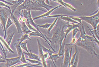 人黑素瘤细胞系WM-266-4(STR鉴定正确) Human melanoma cell line WM-266-4