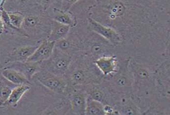 血管内皮细胞系ECV-304(STR鉴定正确) ECV-304 endothelial cells