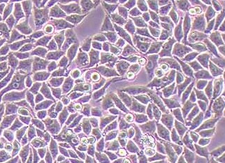 人结直肠癌细胞系胞P53R(STR鉴定正确) Human colorectal cancer cell P53R