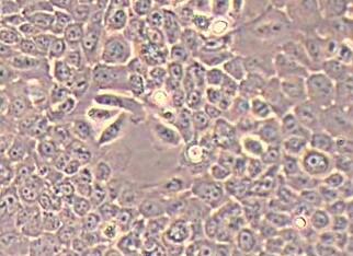 人支气管上皮样细胞系 HBE HBE135-E6E7(STR鉴定正确) Human bronchial epithelial cells HBE HBE135-E6E7