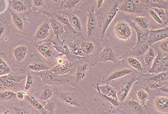 人永生化鼻咽上皮细胞系NP69(STR鉴定正确) Human immortalized nasopharyngeal epithelial cell line NP69