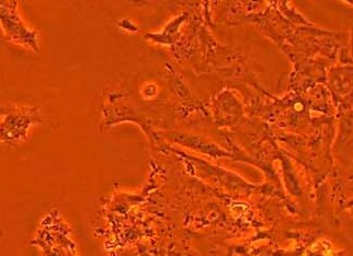 人巩膜成纤维细胞(原代细胞) human scleral fibroblasts HSF