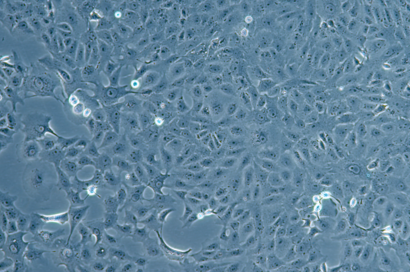 非洲绿猴肾细胞耐顺铂VEROC1008(E6)+DDP African green monkey kidney cells resistant to cisplatin VEROC1008 (E6)+DDP