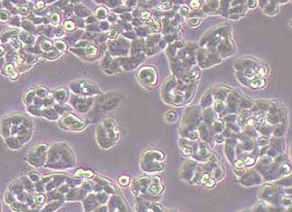 人卵巢癌耐紫杉醇耐药株A2780+Taxol Human ovarian cancer resistant strain A2780+Taxol