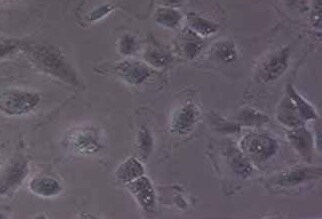 人膀胱癌耐顺铂细胞株T24+DDP(STR鉴定正确) Cisplatin resistant human bladder cancer cell line T24+DDP