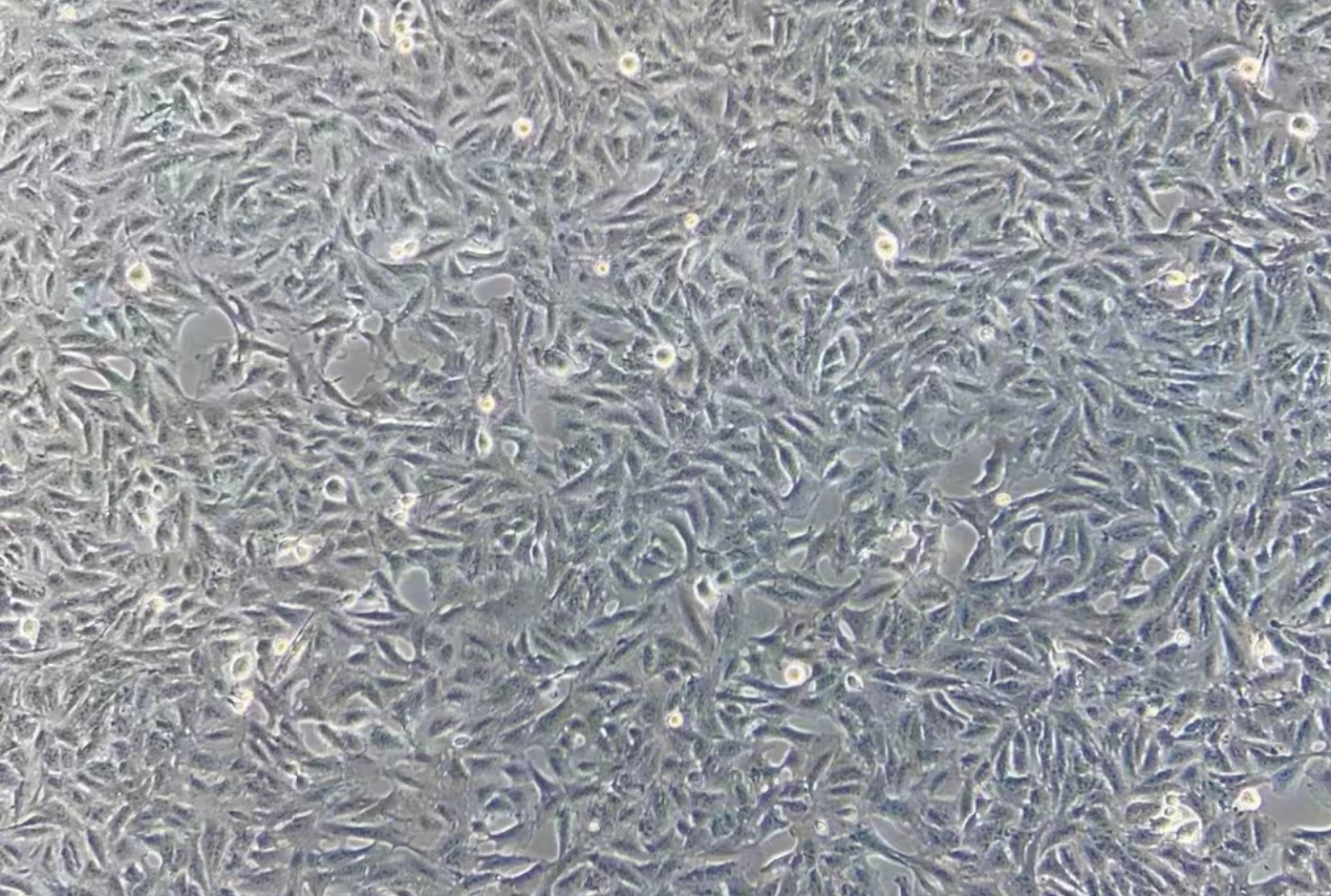 肺癌紫杉醇耐药株A549+Taxol(STR鉴定正确) Lung cancer paclitaxel resistant strain A549+Taxol