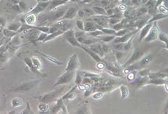 人膀胱上皮永生化细胞带绿色荧光SV-HUC-1+GFP Human bladder skin immortalized cells with green fluorescence SV-HUC-1+GFP
