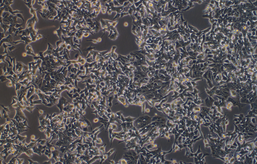 人结直肠癌细胞荧光素酶标记 LOVO+luc (STR鉴定正确) Human colorectal cancer cells labeled with luciferase LOVO+luc