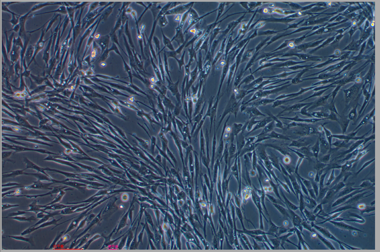 人主动脉平滑肌细胞永生化 Immortalization of human aortic smooth muscle cells